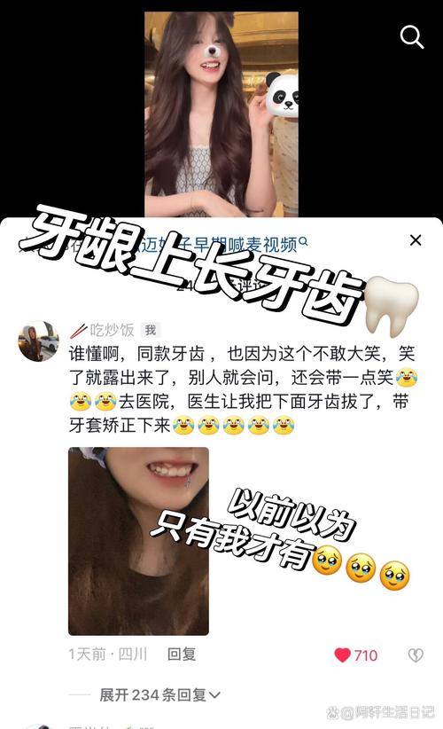 咬合牙长长种牙怎么办-图2 咬合牙长长种牙怎么办-图2