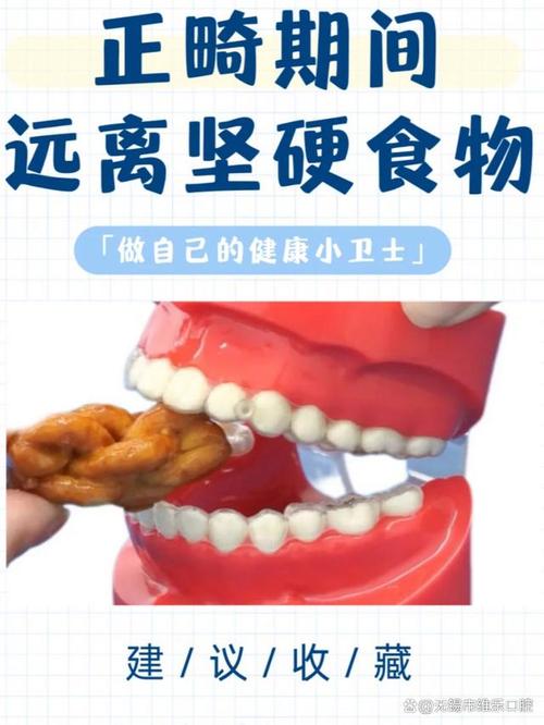 正畸戴颌垫吃东西，会有哪些影响？该怎么吃？-图2