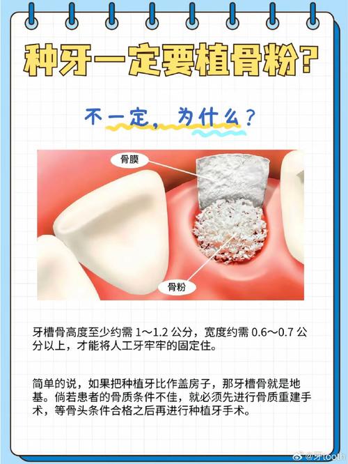 种牙后牙松动了怎么办?-图2 种牙后牙松动了怎么办?-图2