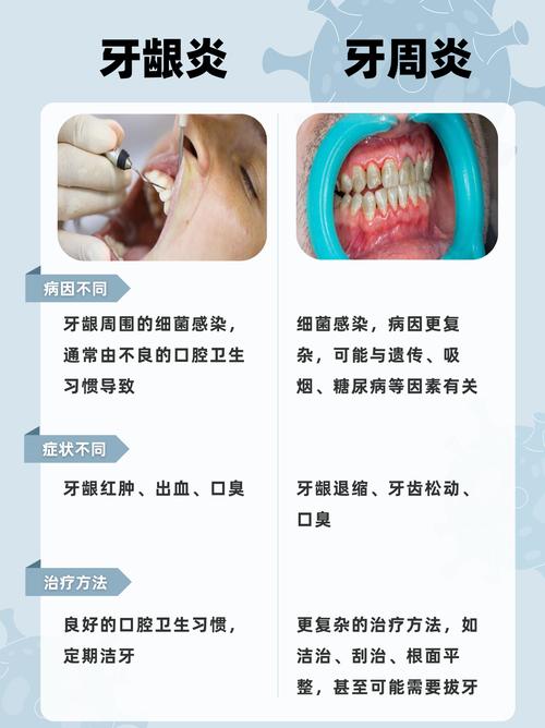 牙周好坏与种牙成败之间到底存在怎样的必然联系?-图1 牙周好坏与种牙成败之间到底存在怎样的必然联系?-图1