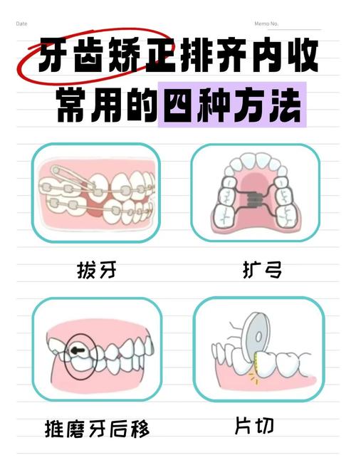 儿童牙齿不齐,矫正方法有哪些选择?-图3 儿童牙齿不齐,矫正方法有哪些选择?-图3
