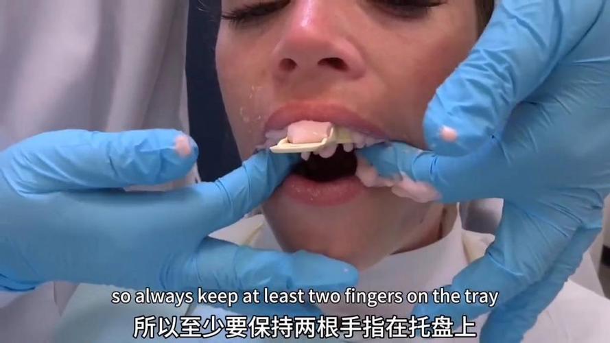 印模的灌注方法及步骤-图3