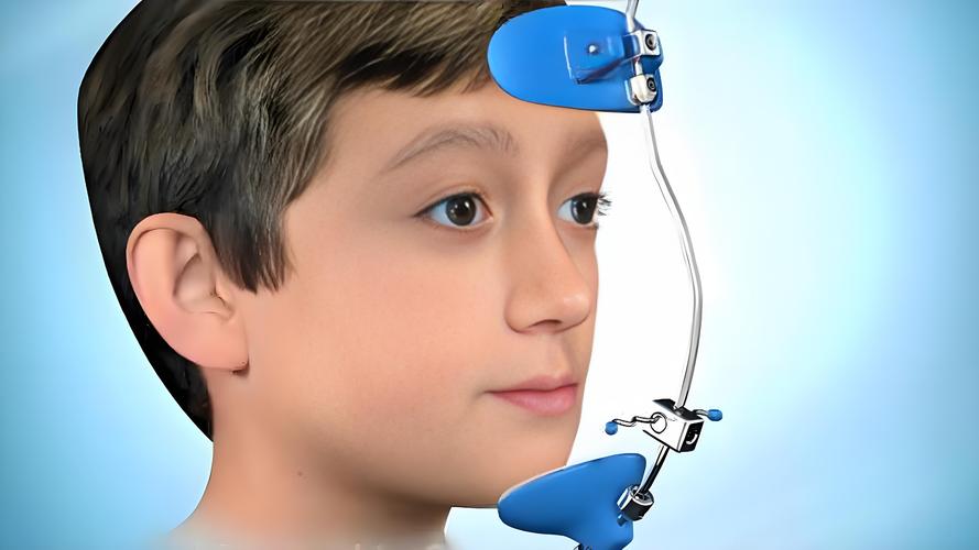 正畸头帽牵引装置的作用-图1