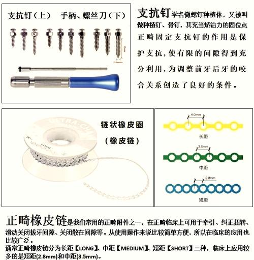 口腔正畸支抗钉英文缩写-图2