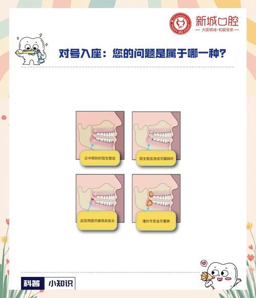 没有智齿还少颗牙，正畸方案怎么定？-图2