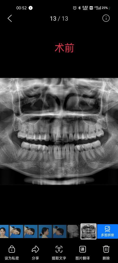 昆明拜博口腔正畸-图1