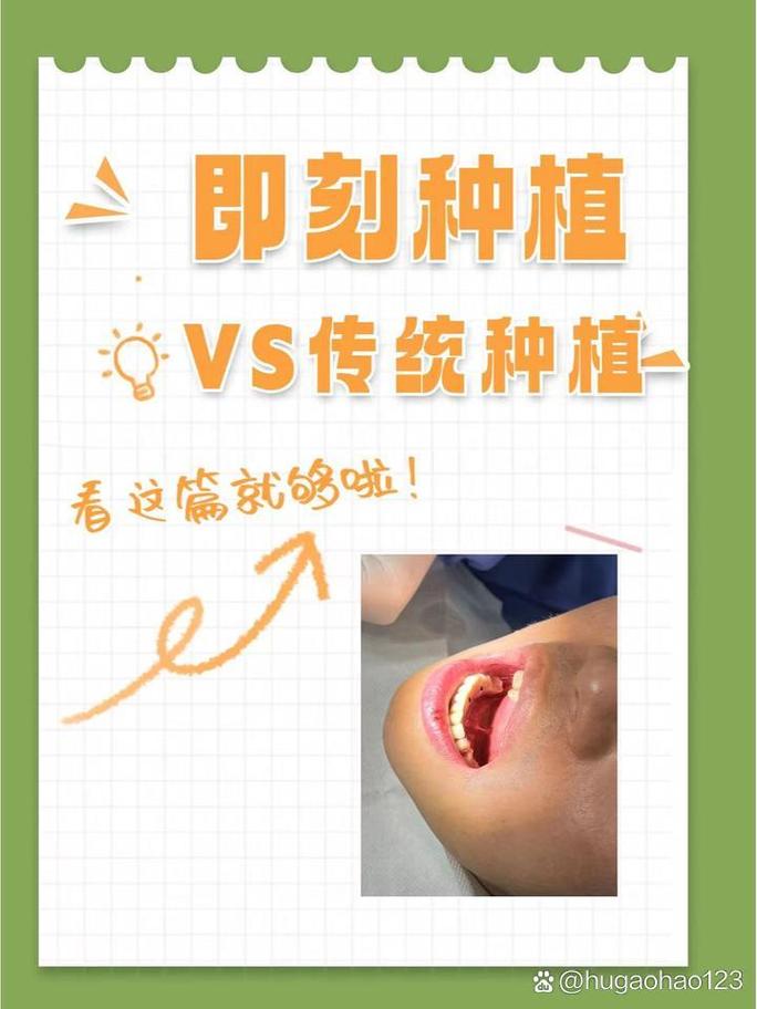 即刻种植牙与传统种牙有何区别？哪个更适合你？-图1