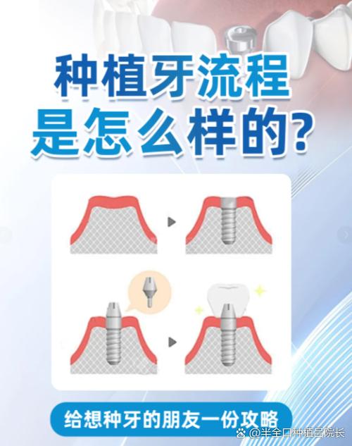 牙骨条件不好怎么种牙-图1