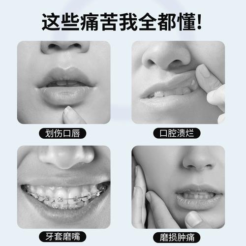 正畸保护蜡怎么使用视频-图3