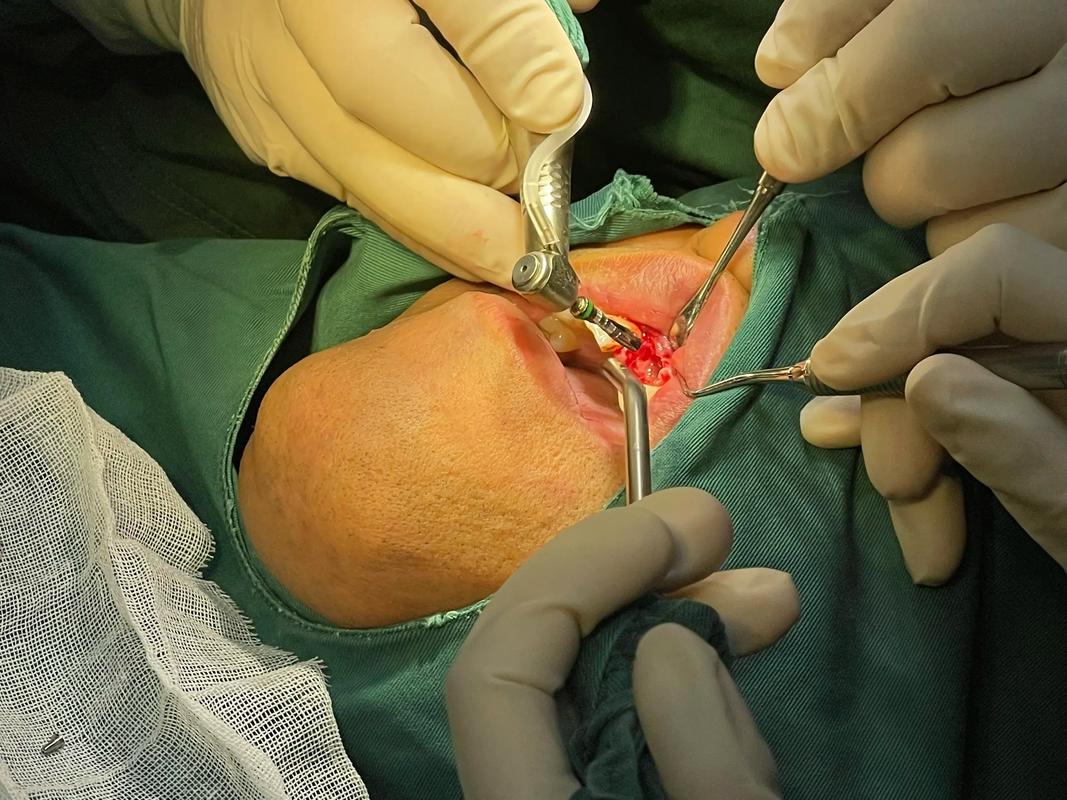 青岛 种牙 2025-图2