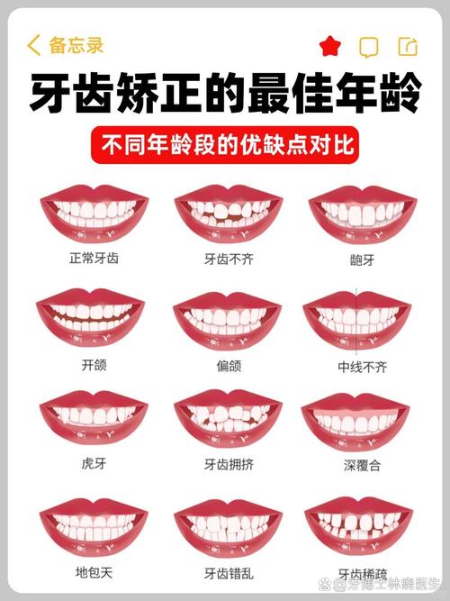 上海哪个牙齿正畸治疗好?专业医院效果口碑如何选靠谱?-图1 上海哪个牙齿正畸治疗好?专业医院效果口碑如何选靠谱?-图1