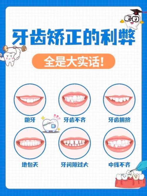 成人牙齿正畸究竟有什么好处?-图2 成人牙齿正畸究竟有什么好处?-图2