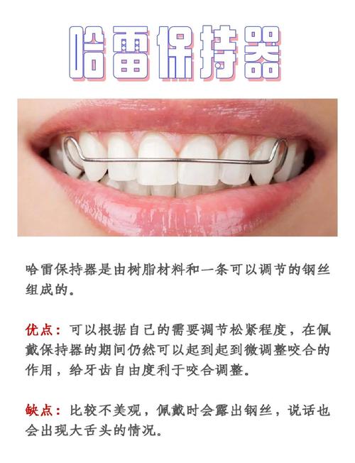 如何正确取下保持器?操作步骤有哪些?-图2 如何正确取下保持器?操作步骤有哪些?-图2