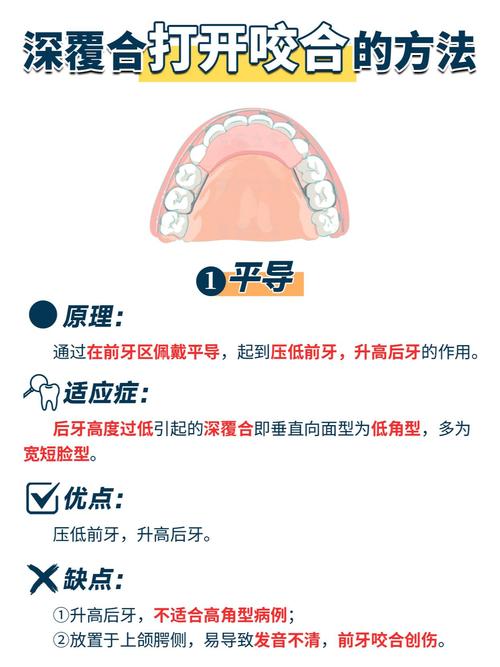 摇椅弓打开咬合的方法是什么?技术要点与临床应用-图2 摇椅弓打开咬合的方法是什么?技术要点与临床应用-图2