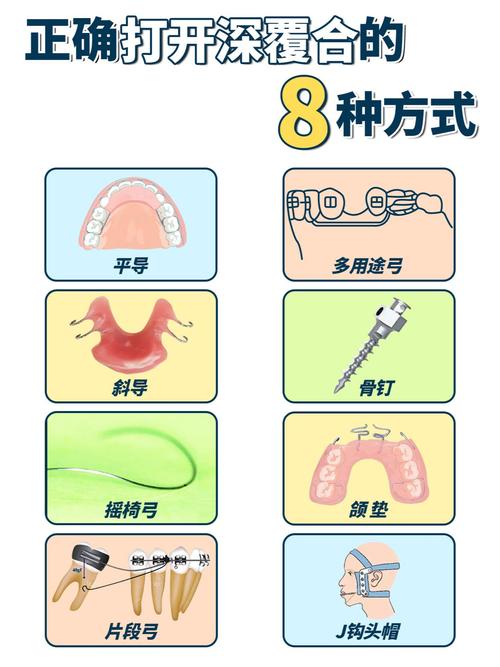摇椅弓打开咬合的方法是什么?技术要点与临床应用-图1 摇椅弓打开咬合的方法是什么?技术要点与临床应用-图1