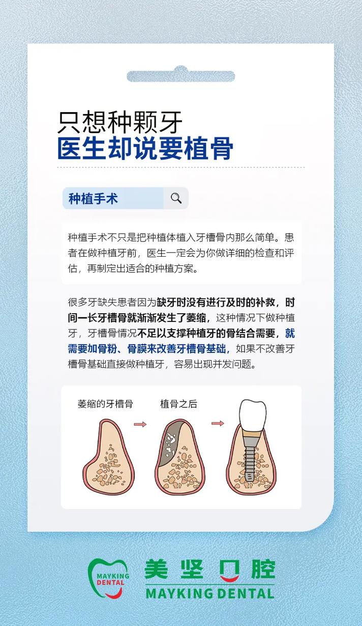 种牙什么情况下要植骨-图2