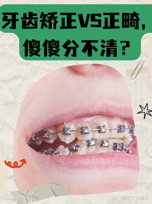 牙齿矫正几种方法的主要区别是什么?-图2 牙齿矫正几种方法的主要区别是什么?-图2