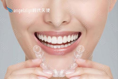 拜博口腔的时代天使矫正服务如何?效果和口碑真的值得信赖吗?-图1 拜博口腔的时代天使矫正服务如何?效果和口碑真的值得信赖吗?-图1