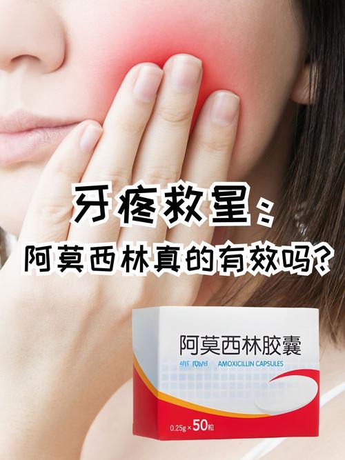 种牙后吃消炎药怎么选?有哪些注意事项?-图2 种牙后吃消炎药怎么选?有哪些注意事项?-图2