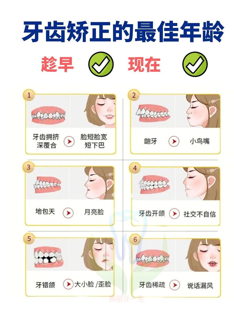 龅牙矫正有哪些方法?-图1 龅牙矫正有哪些方法?-图1