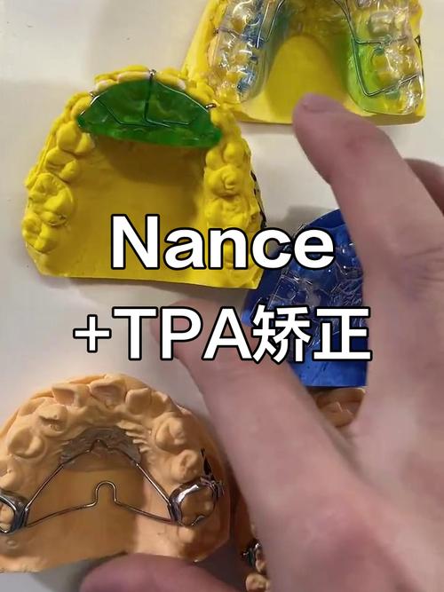 正畸nance托怎么玩-图2 正畸nance托怎么玩-图2