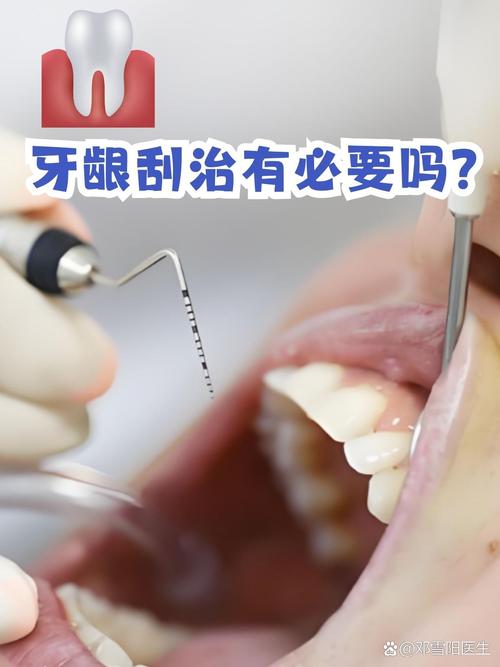 牙周炎手术有几种方法-图3 牙周炎手术有几种方法-图3