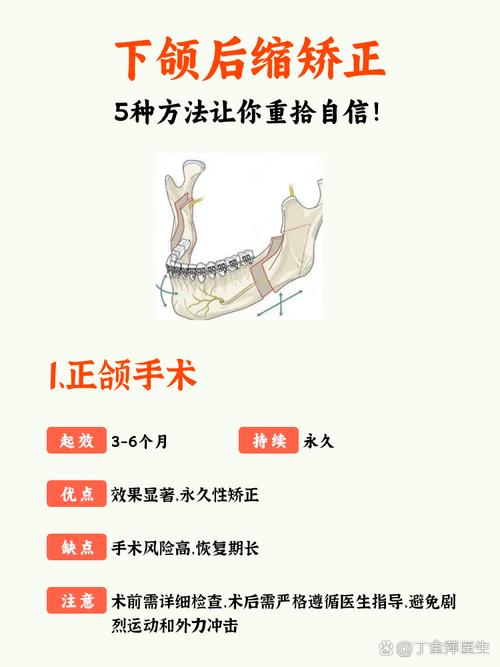 防止下颌骨变宽的方法-图1 防止下颌骨变宽的方法-图1