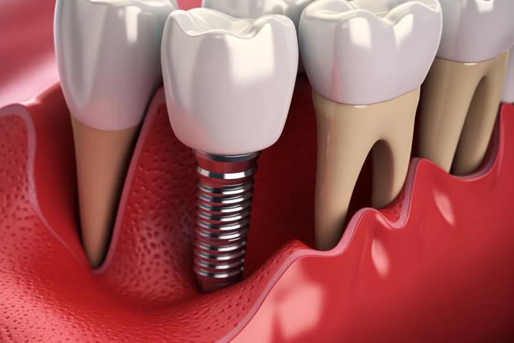 临床正畸摄影技术ppt-图1 临床正畸摄影技术ppt-图1
