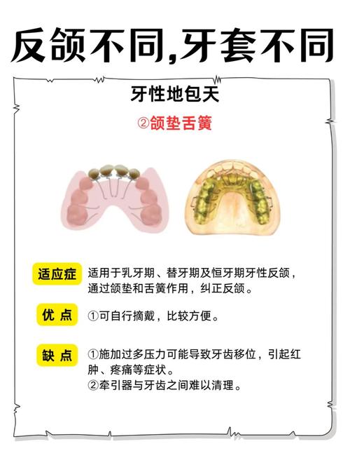 矫正地包天有那些方法-图1 矫正地包天有那些方法-图1