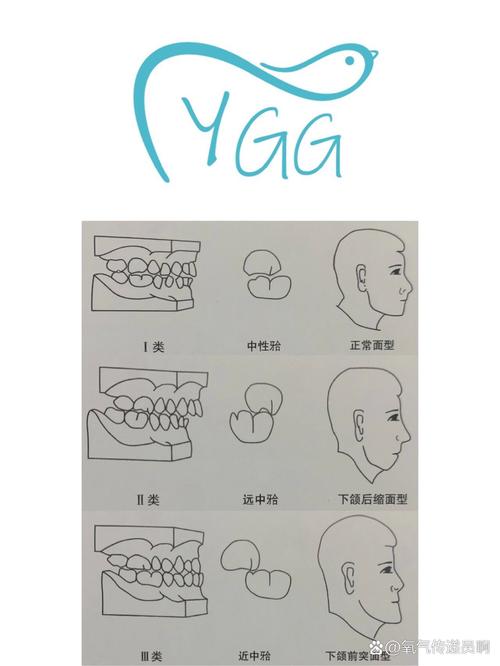 如何用最简单的方法调整磨牙倾斜？-图3