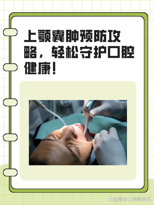 下巴囊肿怎么治疗方法-图1 下巴囊肿怎么治疗方法-图1