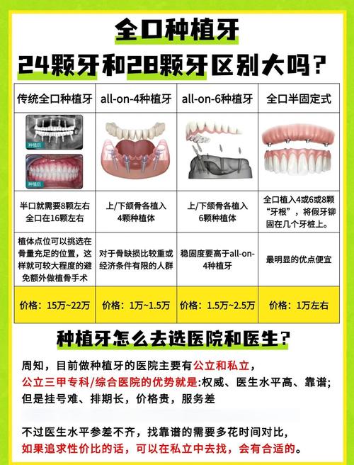 全口种植牙需要种几棵-图3