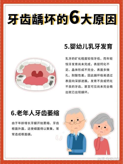 小孩邻面龋齿治疗方法-图2