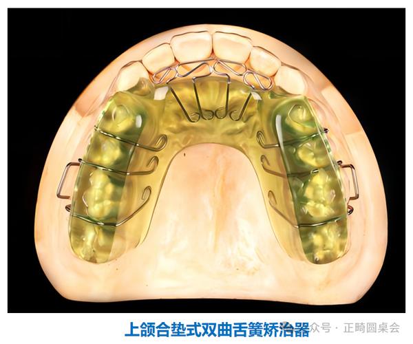 正畸联合创新Damon，疗效提升有何新突破？-图3