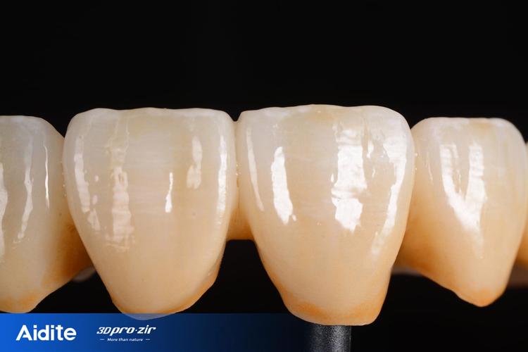 种牙后牙冠选什么材质?不同材质优缺点如何挑选合适?-图2 种牙后牙冠选什么材质?不同材质优缺点如何挑选合适?-图2