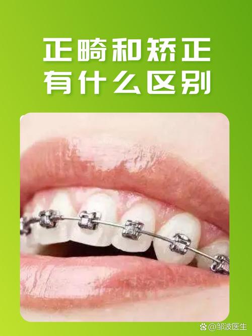 正畸一科与正畸二科区别-图1 正畸一科与正畸二科区别-图1
