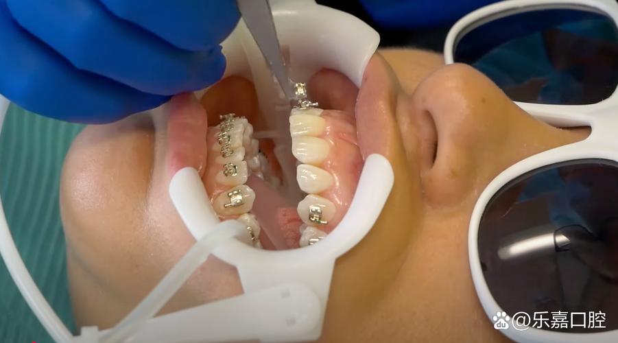 keynote口腔正畸-图1