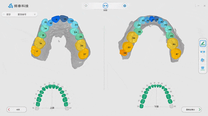 cadcam 口腔正畸-图1