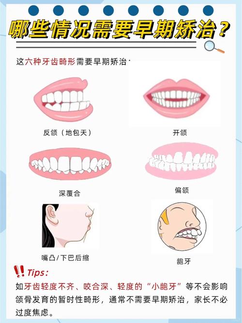 牙列拥挤常用矫治方法-图2