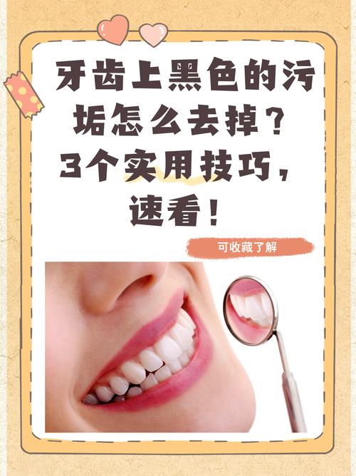 牙齿变黑变黄物理方法-图2