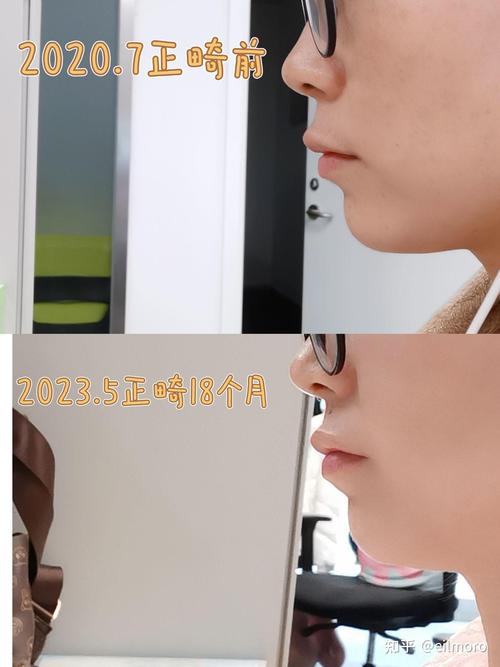 北大口腔二门诊正畸科-图1