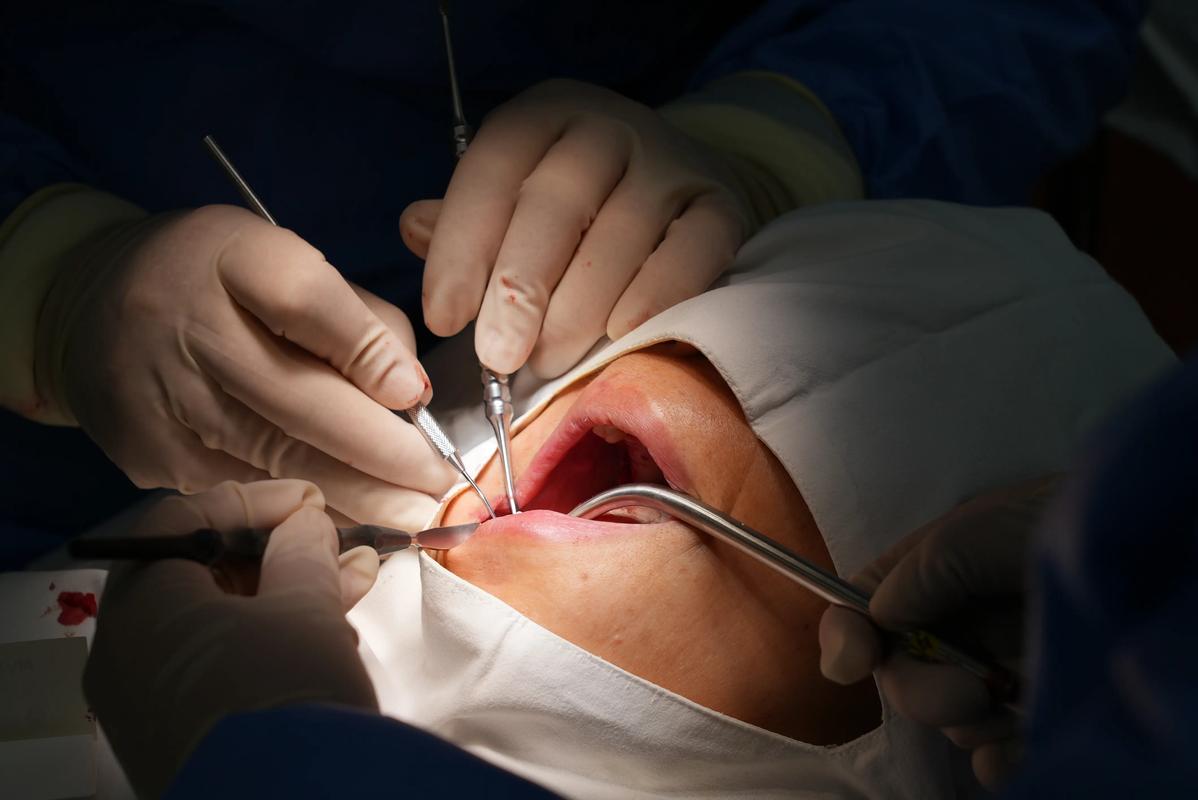 沈阳医大口腔医院种牙-图3 沈阳医大口腔医院种牙-图3