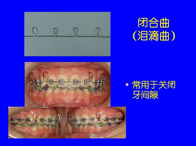 中国医科大口腔正畸学有何独特技术优势?-图1 中国医科大口腔正畸学有何独特技术优势?-图1