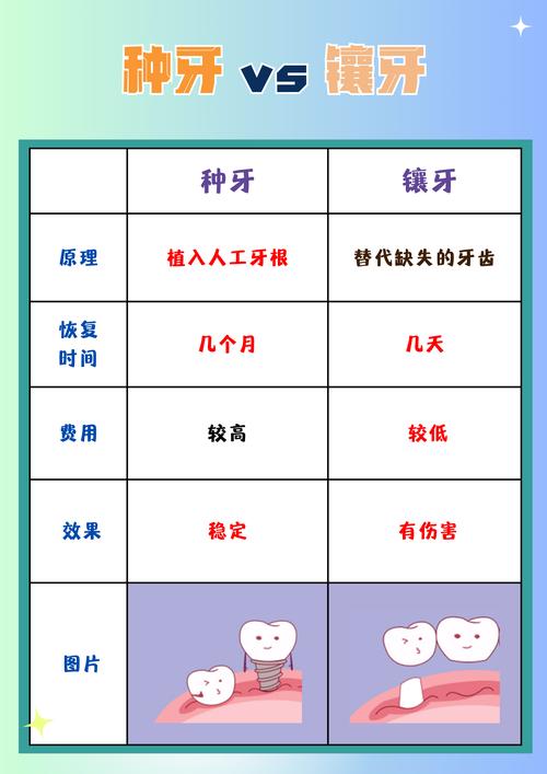 前牙种牙好还是镶牙好-图1 前牙种牙好还是镶牙好-图1