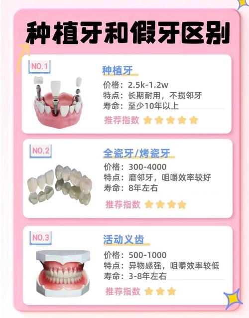 前牙种牙好还是镶牙好-图2 前牙种牙好还是镶牙好-图2