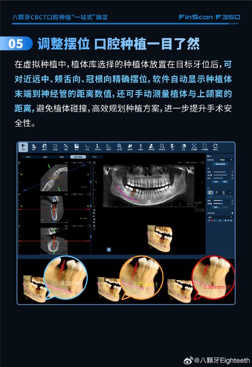 种牙CT检查的危害具体有哪些？-图3
