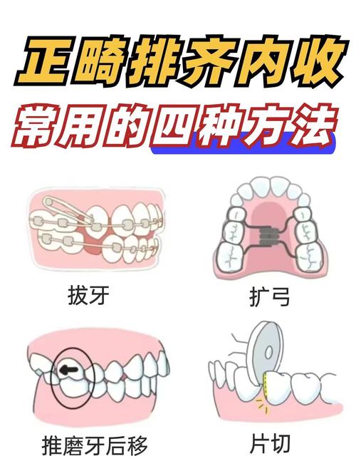 矫正拉磨牙用什么方法最有效？-图1