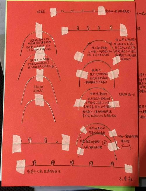 正畸钢丝弯制方法图解-图1 正畸钢丝弯制方法图解-图1
