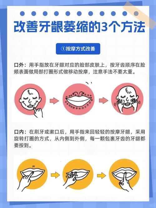 种牙后如何有效防止牙龈萎缩?-图1 种牙后如何有效防止牙龈萎缩?-图1