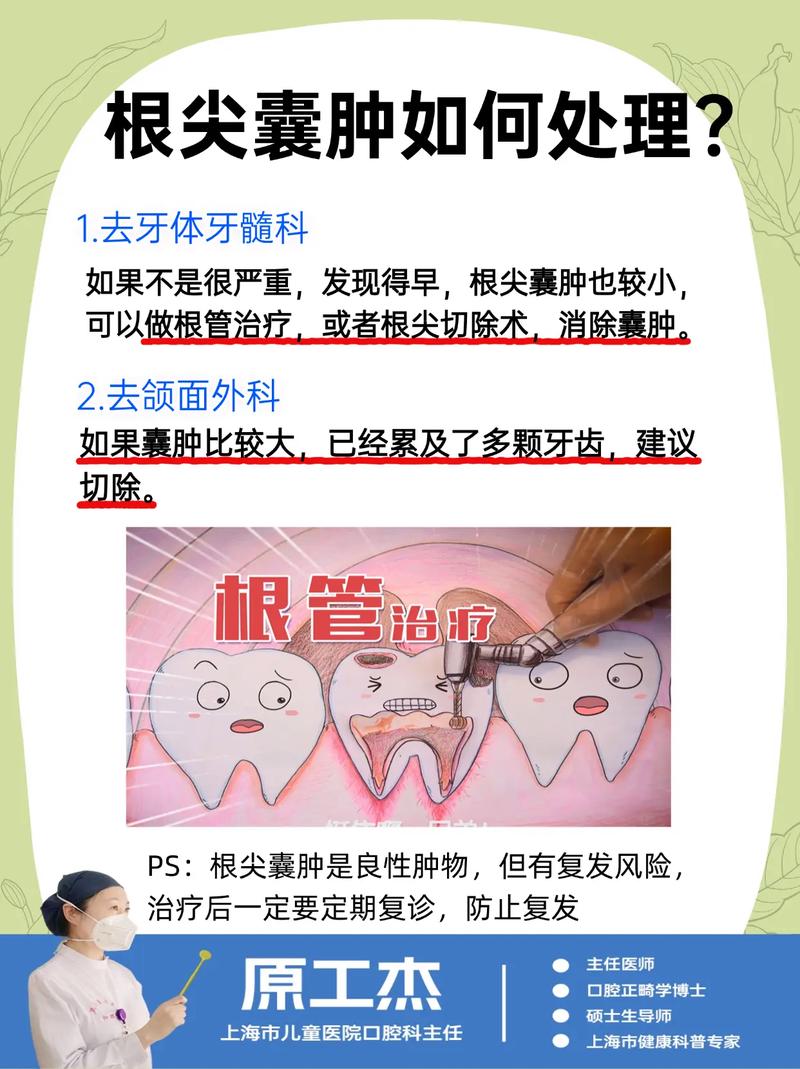 口腔囊肿如何治疗方法-图3